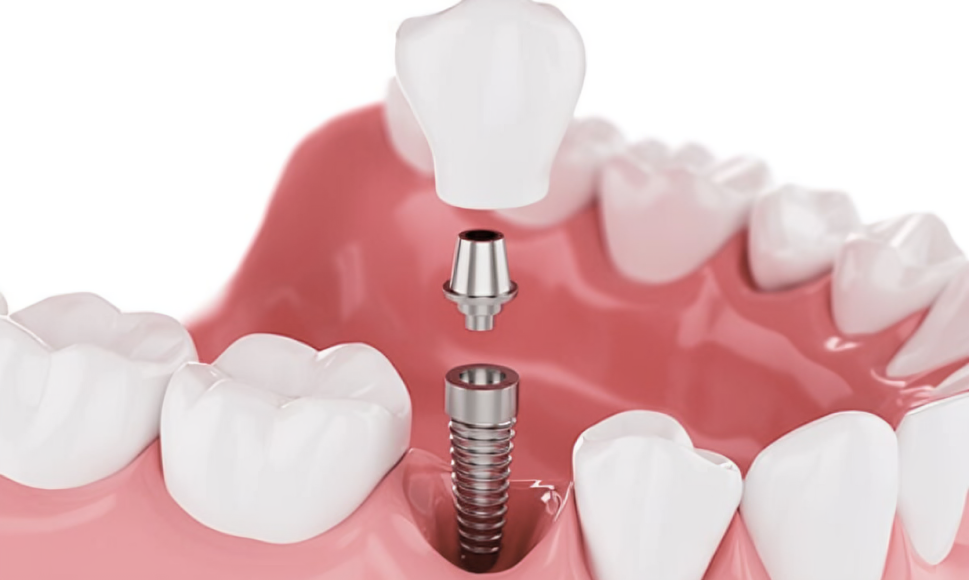 Design-sem-nome-64-2-1